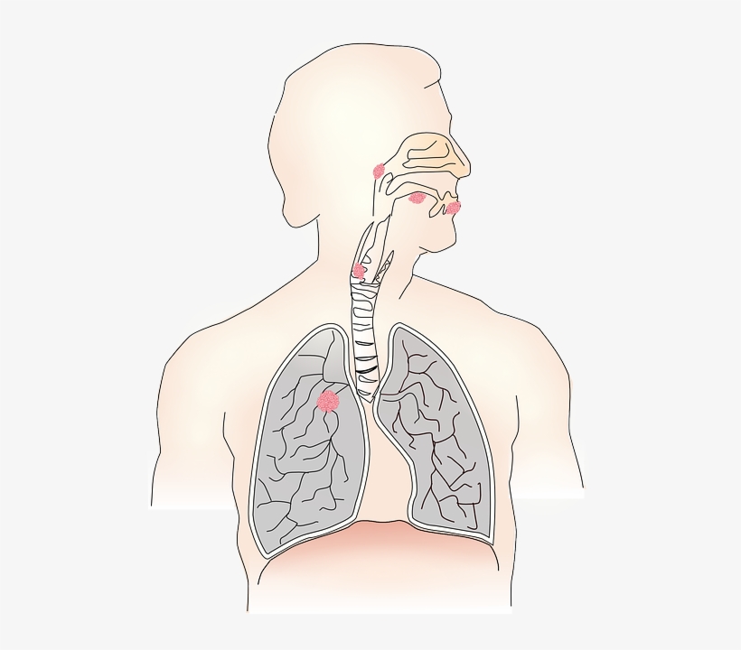 Come Curare La Bronchite Acuta, transparent png download