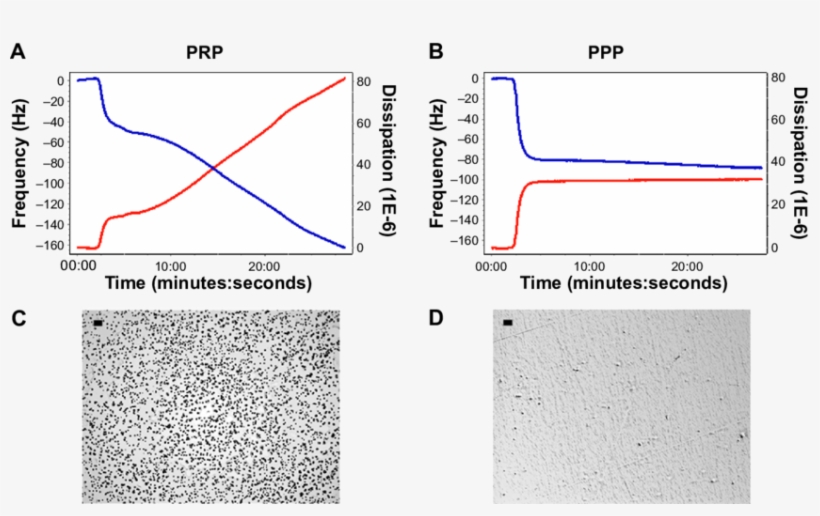 Quartz Crystal Microbalance With Dissipation - Diagram, transparent png download