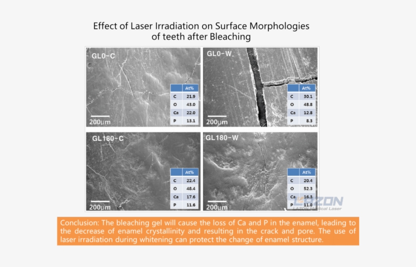 Surface Morphologies Of Teeth After Laser Whitening - Laser, transparent png download