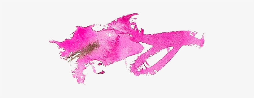 Pink Splotch - Illustration, transparent png download