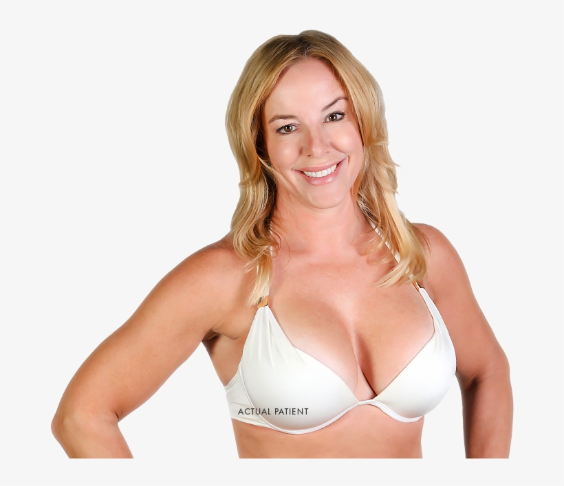 Breast Lift With Implants Model - Mastopexy, transparent png download