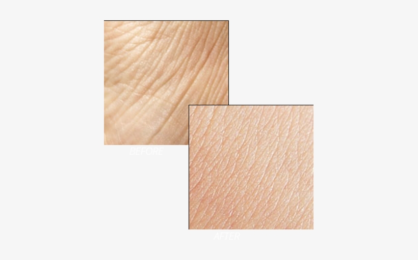 Related Wallpapers - Anti-aging Cream, transparent png download