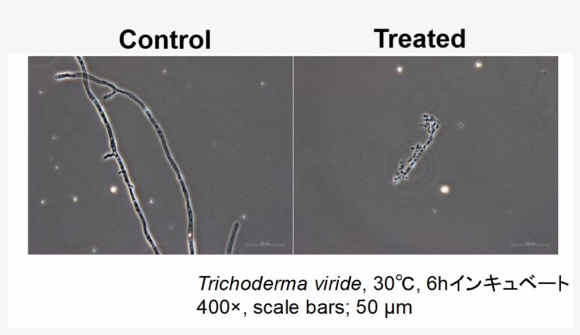 Scale Bar Is 50 Μm - Portable Network Graphics, transparent png download