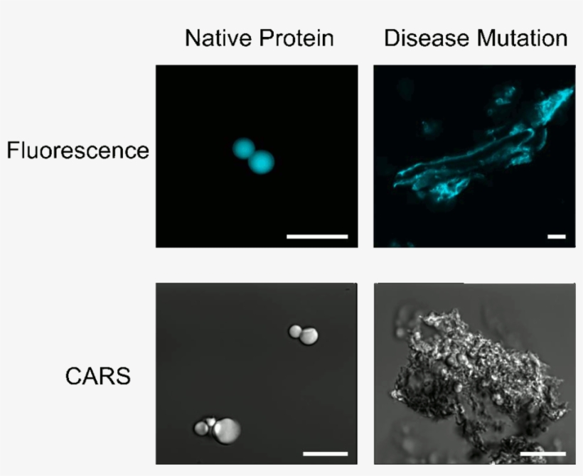 Native And Disease Mutated Rnp Granule Proteins - Micrometre, transparent png download
