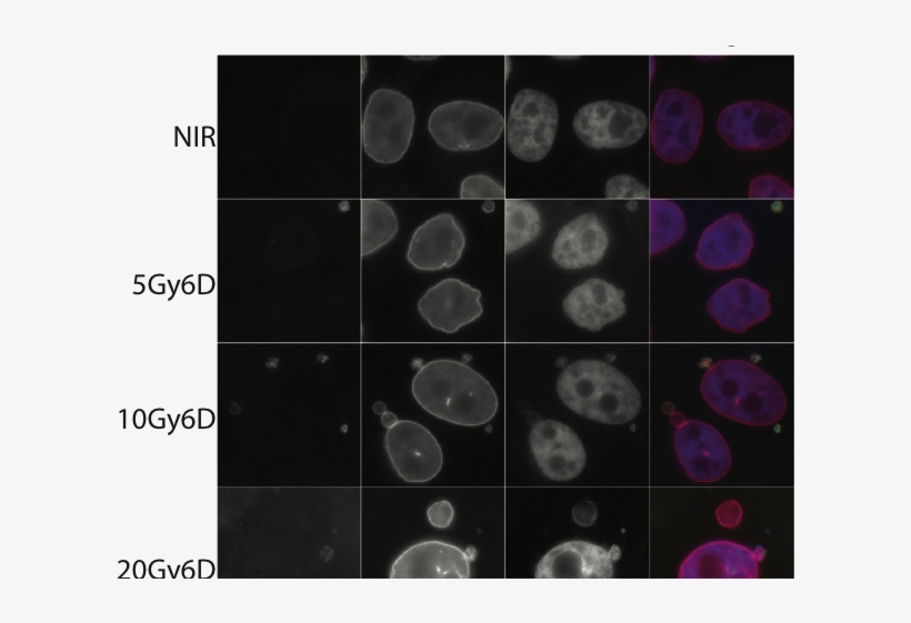 Immunofluorescent Staining Shows Co-staining Of Lamin - Micronuclei Cgas, transparent png download