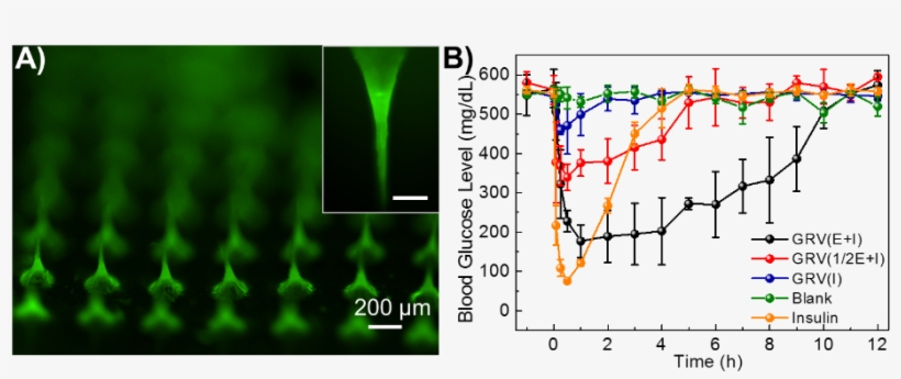 A Fluorescence Microscopy Image Of Mns Loading Grvs - Microneedle Array Glucose, transparent png download