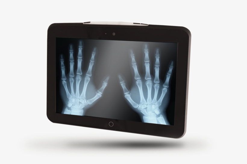 Md101 - X Ray, transparent png download