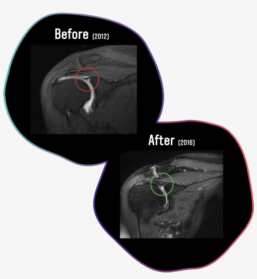 Literature Review Observing Over 1500 Patients Whom - Graphics, transparent png download