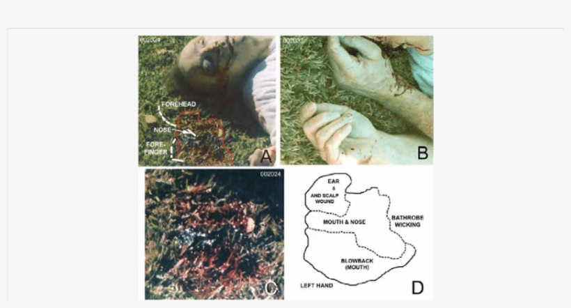 Analysis Of The Bloodstain In The Grass Under And In - Face, transparent png download