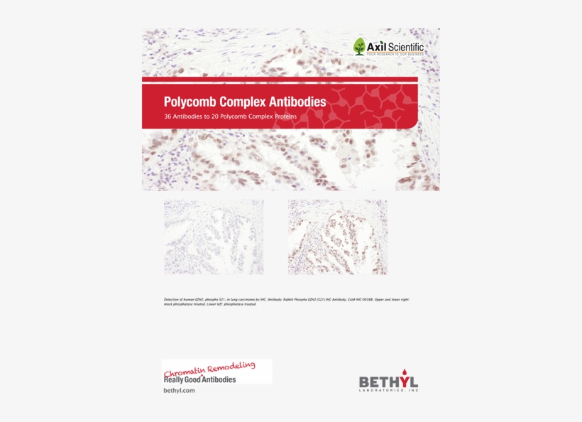 Since Its Founding In 1972, Bethyl Has Manufactured - Axil Scientific, transparent png download