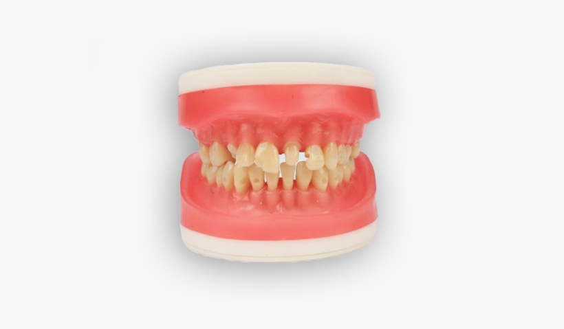 Manequim Materiais Dentários Top - Mannequin, transparent png download