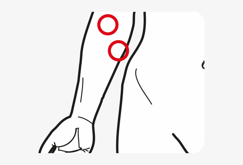 Programmes Ultrasuoni Terapeutici - Forearm, transparent png download