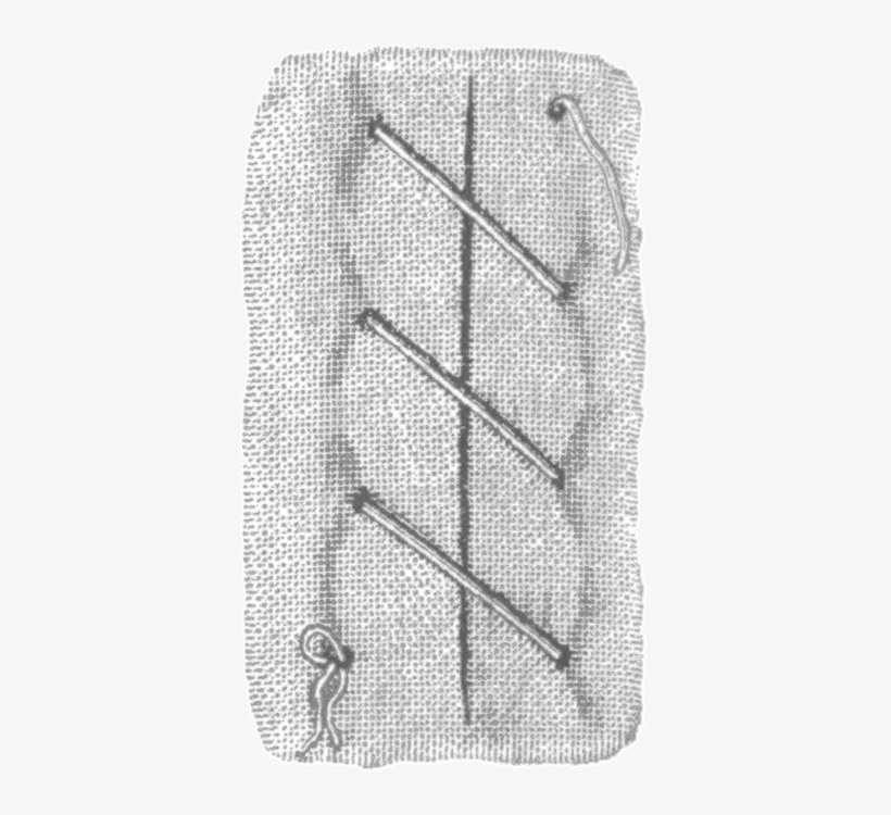 Types Of Stitches Used In Sutures, From Dictionnaire - Types Of Sutures, transparent png download