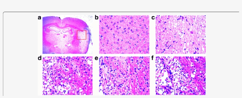The Effect Of Sli Treatment On Neural Cell Injury In - Common Fig, transparent png download
