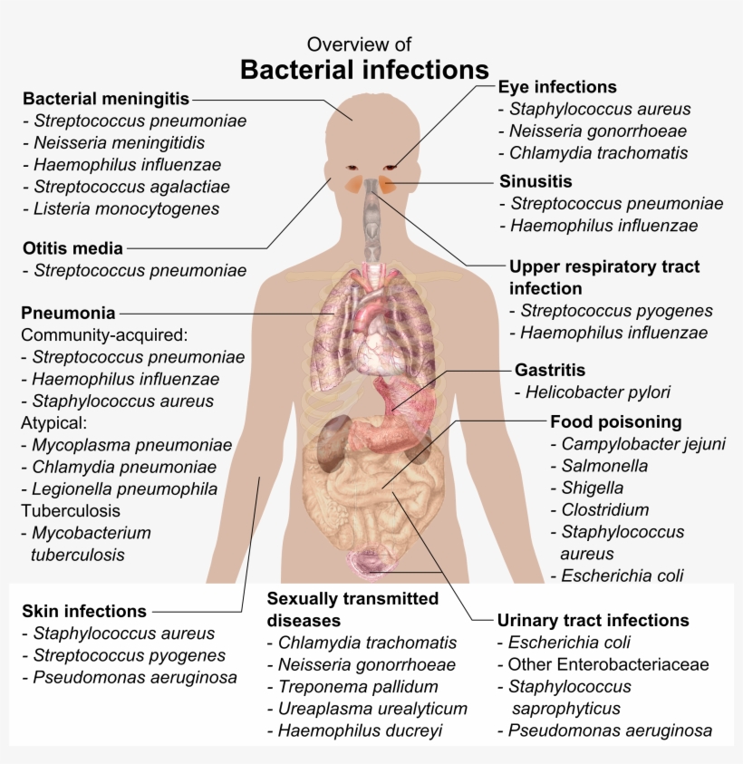 Bacterial Infections And Involved Species - Overview Of Bacterial Infections, transparent png download