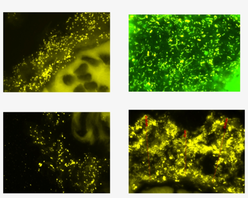 Bacteria, transparent png download