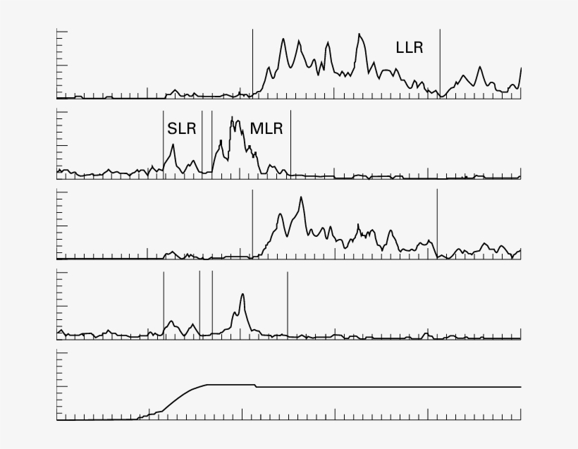 Statokinesigram Recordings From Static Tests Performed - Diagram, transparent png download
