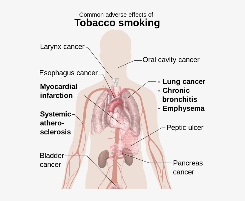 Effects Of Smoking - Common Adverse Effects Of Tobacco Smoking, transparent png download