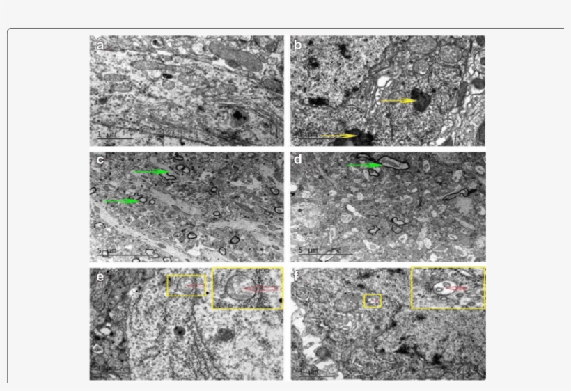 Autophagosomes Existed In Both Control And Diabetic - Hippocampus Ultrastructure, transparent png download