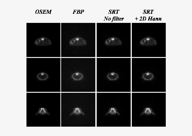 Three Different Slices Of An Fdg Mouse Scan Acquired - Moon, transparent png download