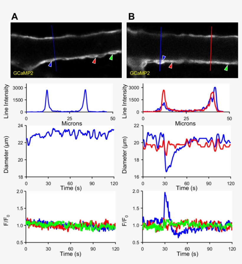 [ca 2 ] Signaling In Gcamp2sm Mouse Arterioles - Diagram, transparent png download