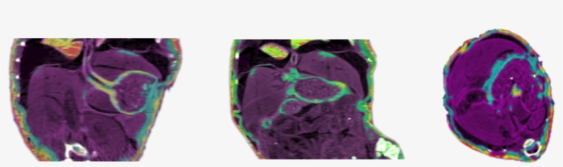 Spectral Computed Tomography Slices Where Each Colour - Portable Network Graphics, transparent png download