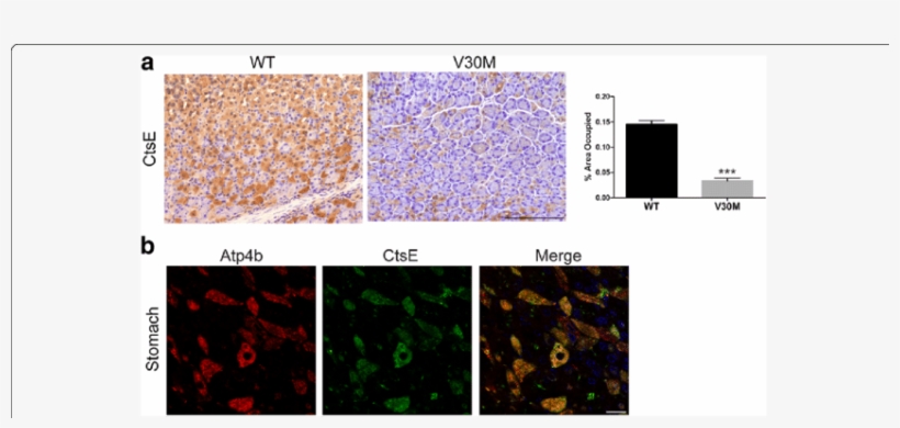 Ctse Protein Levels Are Reduced In The Stomach Of Transgenic - Protein, transparent png download