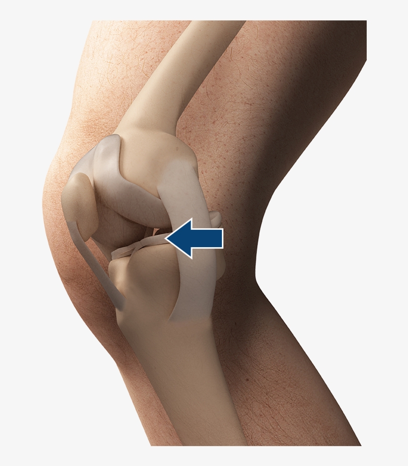 Meniscus - Ligaments Png, transparent png download