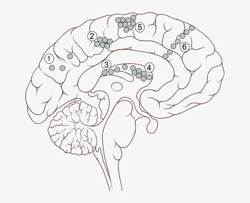 Tsc - Parietal Lobe, transparent png download