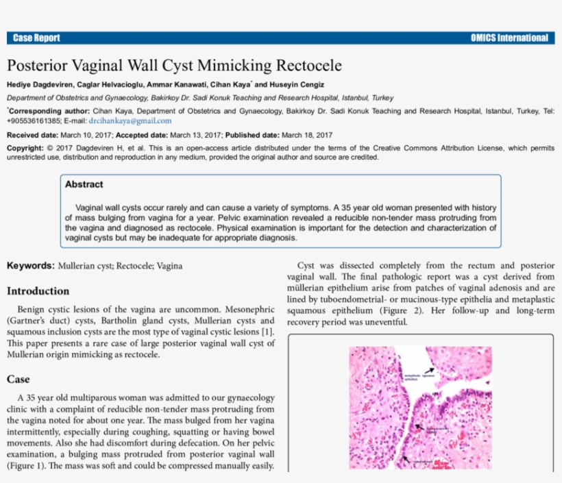 Histopathologic Findings Of Vaginal Cyst - Vaginal Cysts, transparent png download
