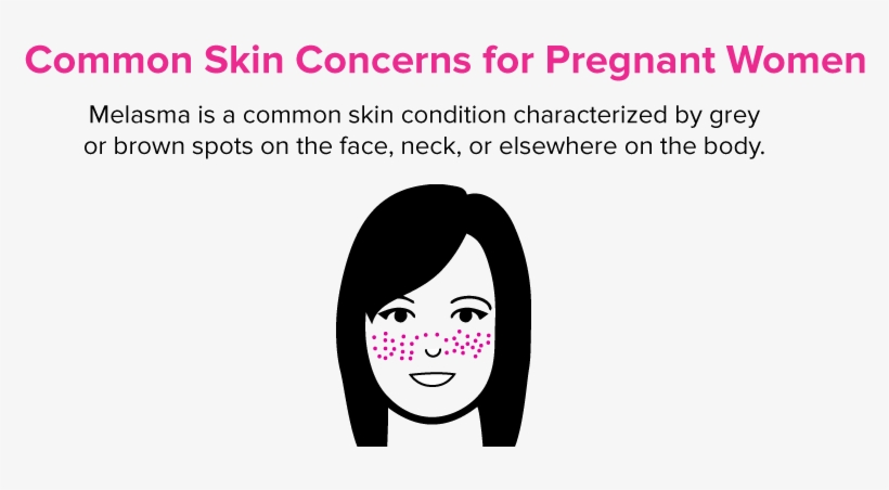 Here Are Some Of The Most Common Skin Concerns That - Cartoon, transparent png download