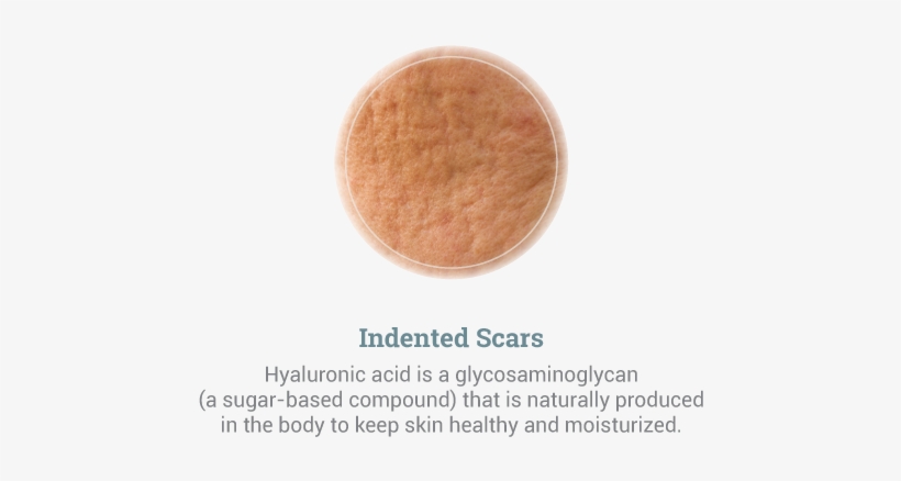 Cosmetic Scar Treatment - Eye Shadow, transparent png download