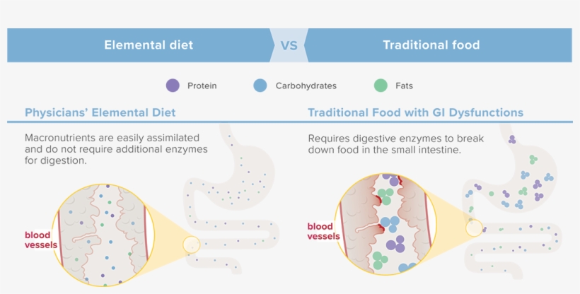 Elemental Diet Vs Traditional Food - Elemental Diet, transparent png download