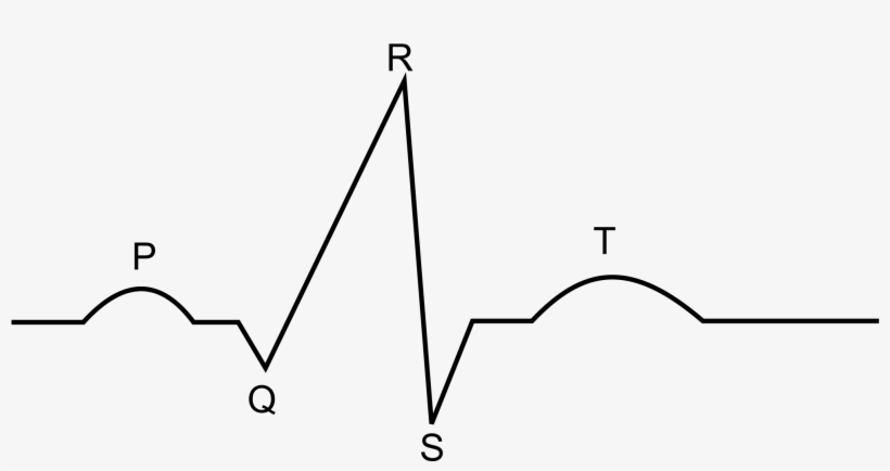Ekg Svg Black And White Ekg Diagram Transparent Png 2000x958 Free Download On Nicepng