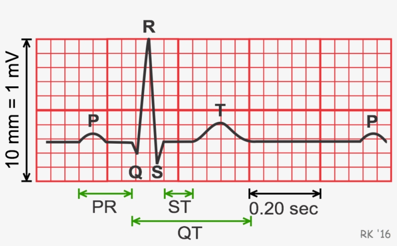 Electrocardiogram Durations And Intervals - Electrocardiography, transparent png download