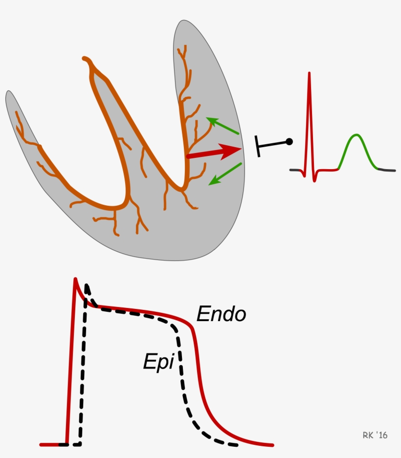 Ecg T Wave Formation - Sinoatrial Node, transparent png download
