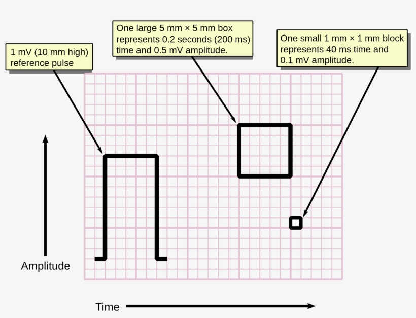 Emcrit Critical Hyperkalemia By H - Measurement, transparent png download