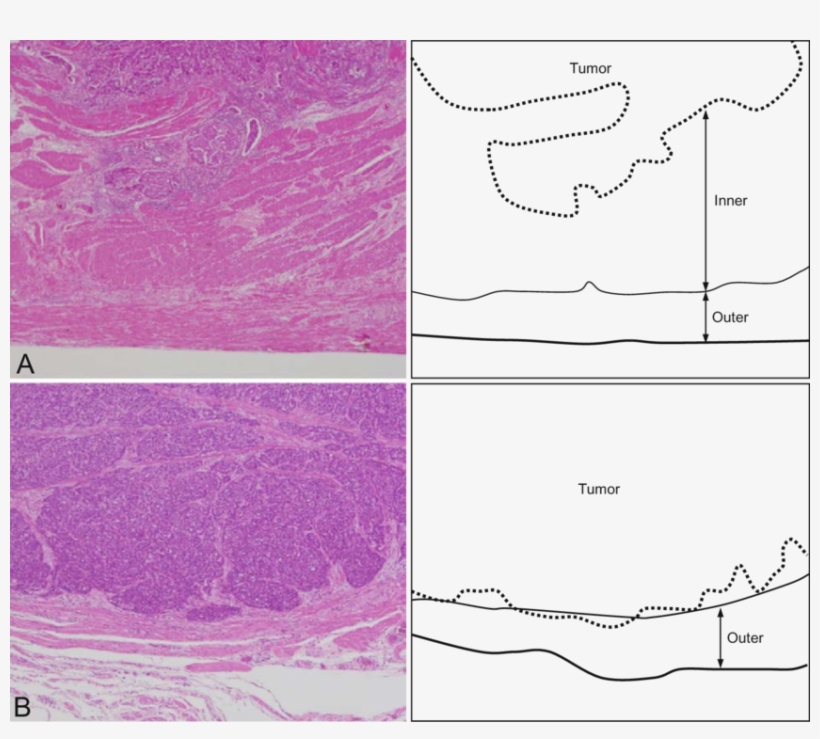 In The Schemas On The Right, The Dotted Lines Show - Drawing, transparent png download
