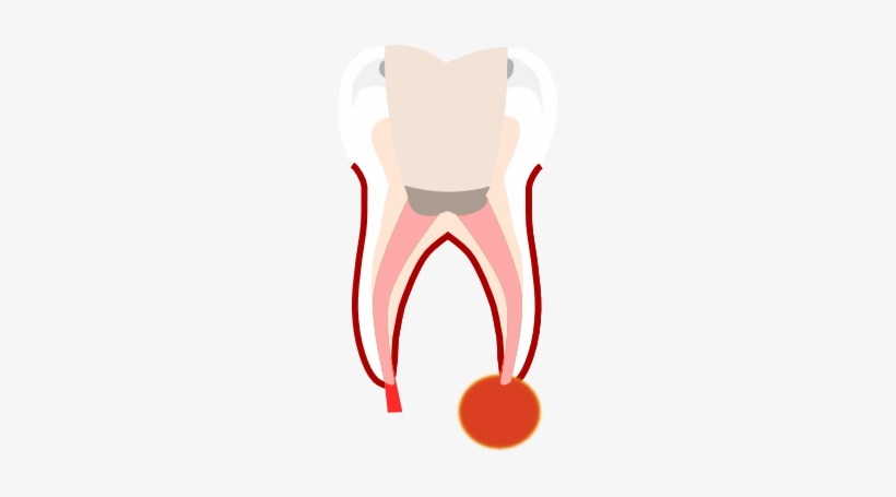 Tooth Clipart Crown, transparent png download