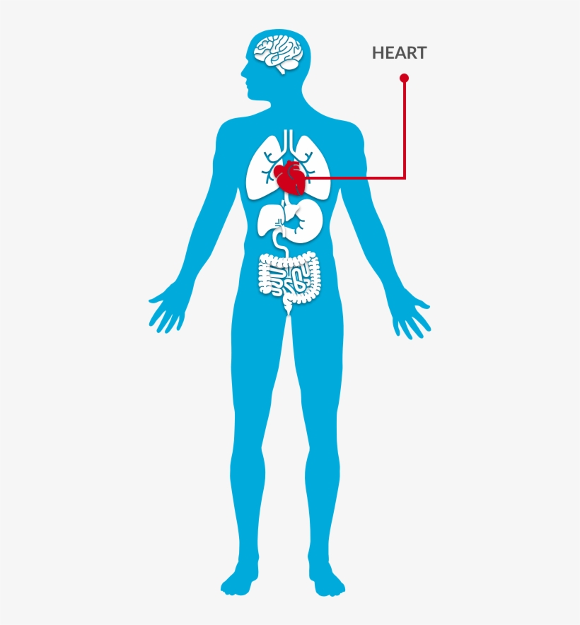 Thoracic Endovascular Aortic Repair - Endovascular Aneurysm Repair, transparent png download