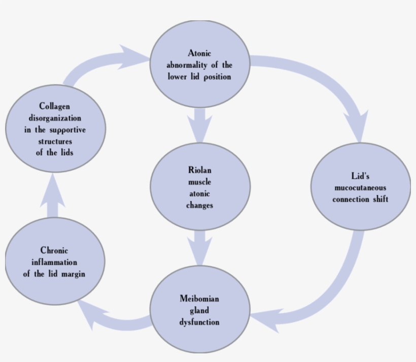 Vicious Circle " Between Meibomian Gland Dysfunction - Diagram, transparent png download