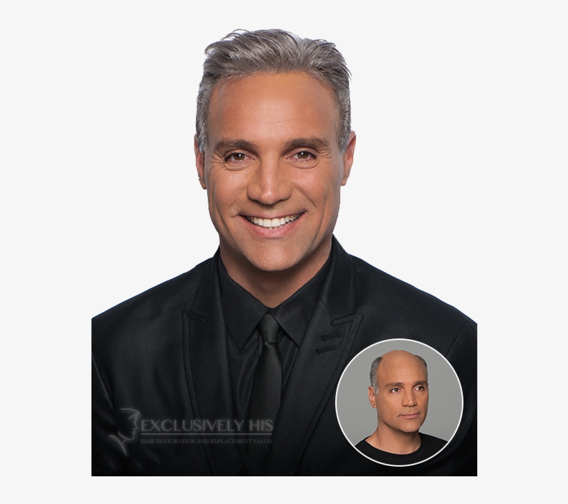 Virtual Reality Benefits - Mens Hair Replaement, transparent png download