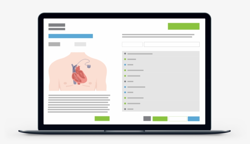 Control New Product Spend - Blackboard Ally, transparent png download