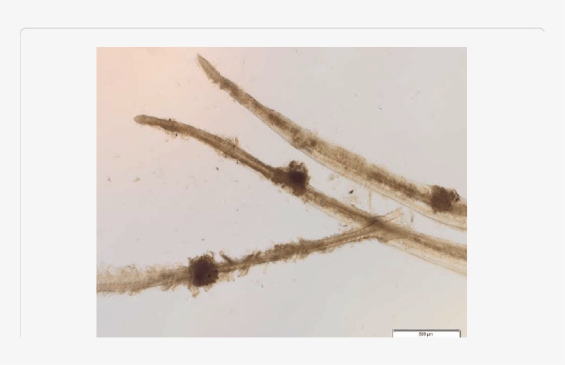 The Cysts Recorded In The Gill Filaments Of Cultured - Brown-marbled Grouper, transparent png download