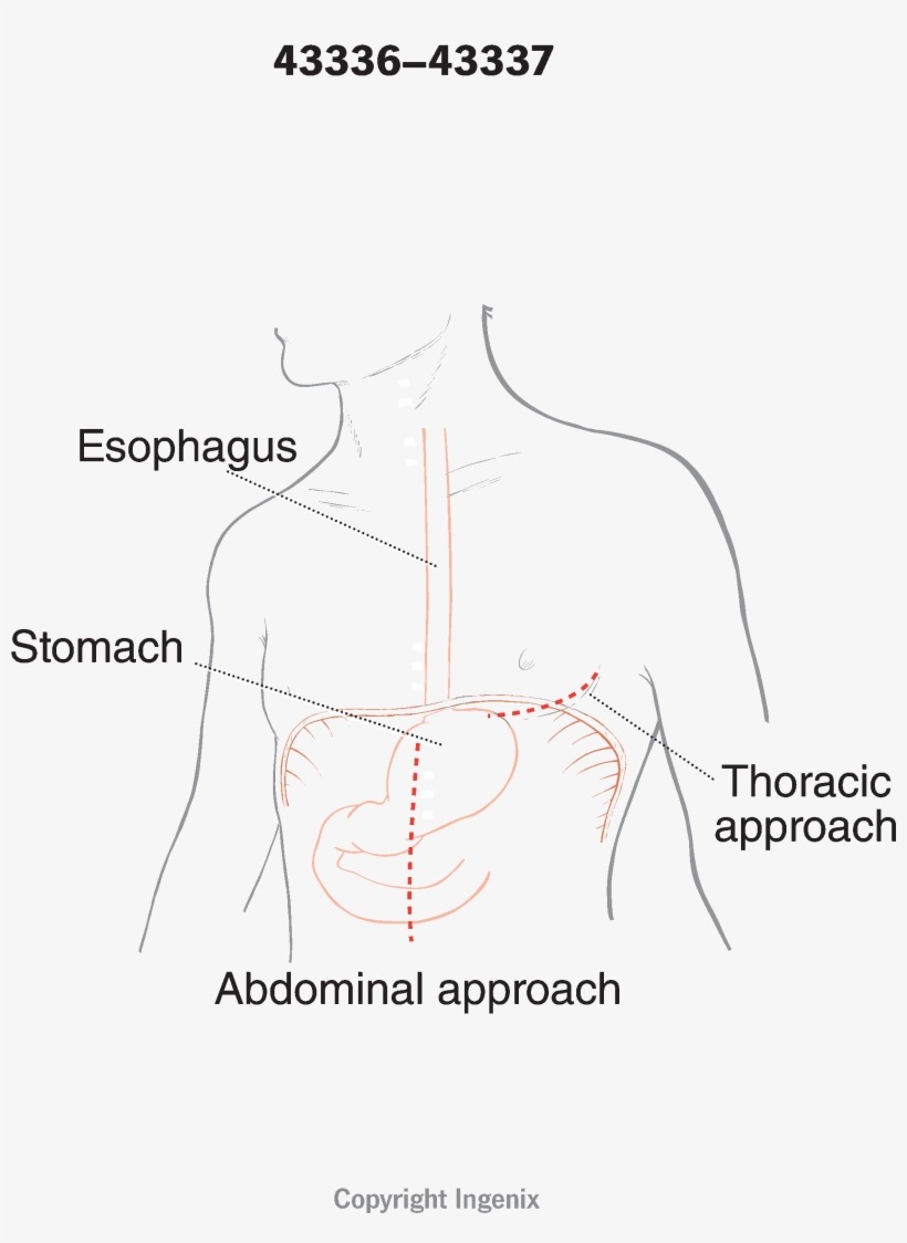 Approach - Diagram, transparent png download
