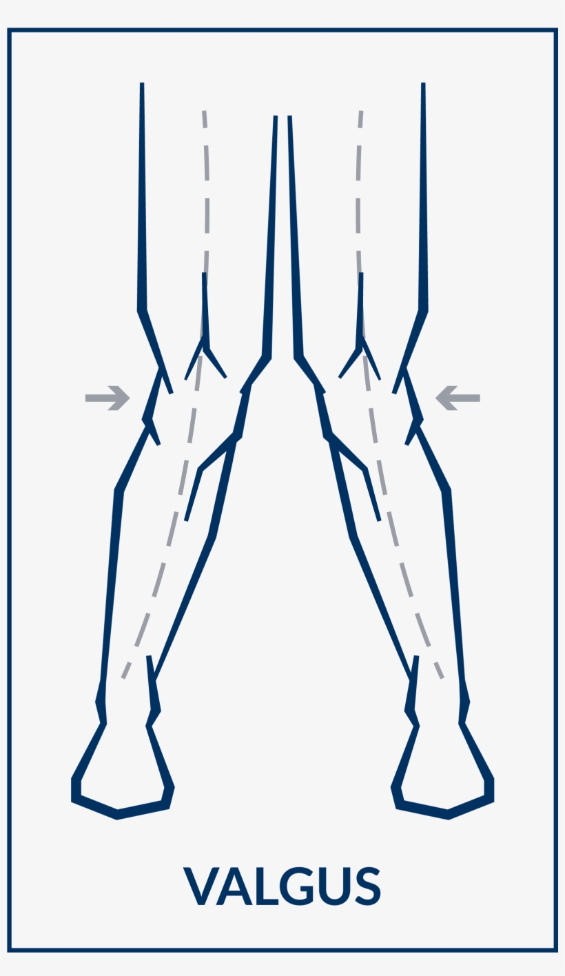 Use The Allen Wrench Provided For Minor Varus/valgus - Art, transparent png download