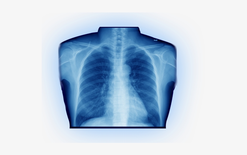 Avoid The Hospital Hassleaffordable X-rays In As Little - Download, transparent png download