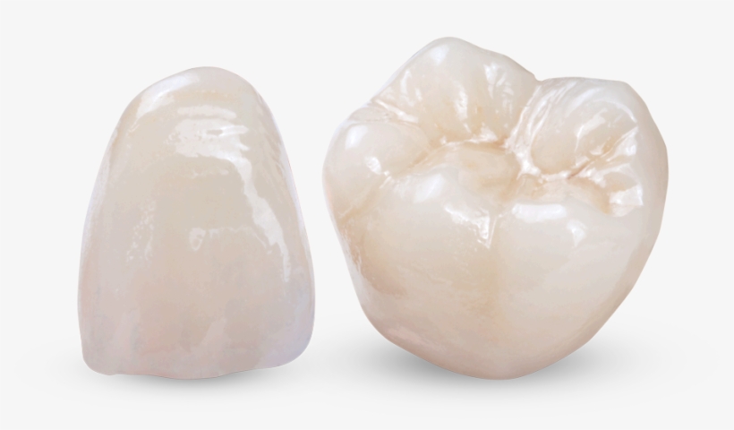 Obsidian All-ceramic Restorations For Bridges, Crowns - Tooth, transparent png download