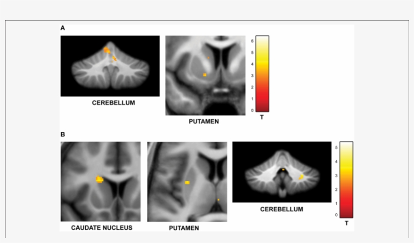 Download - Functional Imaging, transparent png download