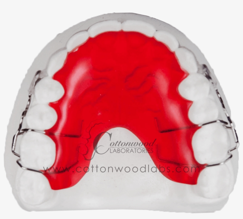 Clear Labialhawley - Arch, transparent png download